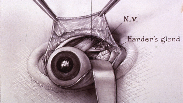 One of five drawings illustrating Johns Hopkins surgeon Warfield Firor's dissection of a rabbit's eye. National Library of Medicine