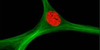 image: Could Stem Cells Cure MS?