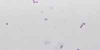 image: Death by Lab-Acquired Infection? 
