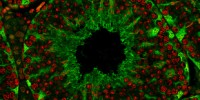 image: Loss of Microtubule Regulator Blocks Sperm Maturation