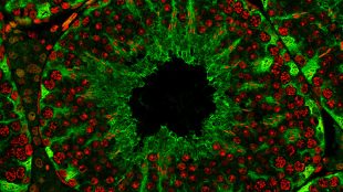 Loss of Microtubule Regulator Blocks Sperm Maturation image: Loss of Microtubule Regulator Blocks Sperm Maturation