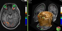 image: fMRI Mind Reader