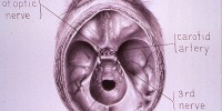 This illustration by medical artist William P. Didusch depicts Firor Warfield's dissection of a monkey skull. National Library of Medicine