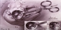 This is figure 4 of five drawings illustration Firor's dissection of a rabbit's eye. It shows the view of a rabbit's skull with two detailed illustrations of left eye cavity indicating the point of perforation.National Library of Medicine