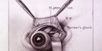 The third of five drawings illustrating Firor's dissection of a rabbit's eye. National Library of Medicine