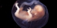 image: Fetal Genome in Mom's Blood