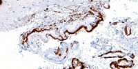 image: Corrupted Proteins Spread Disease
