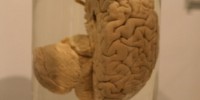 image: Brain Bank Defrost