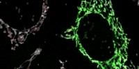image: Fewer Mutations in Tumor Mitochondria