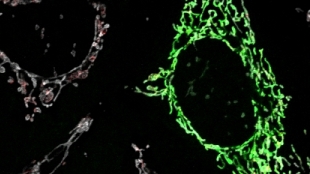 Fewer Mutations in Tumor Mitochondria image: Fewer Mutations in Tumor Mitochondria