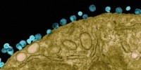 image: Cancer Drug Flushes Out HIV