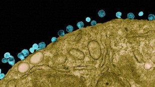Cancer Drug Flushes Out HIV image: Cancer Drug Flushes Out HIV