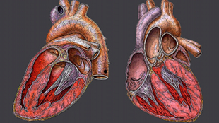 Link to Second Heart Attack Uncovered image: Link to Second Heart Attack Uncovered