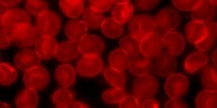 image: Microparticles Deliver Oxygen