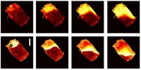 image: Next Generation: The Heart Camera