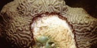 image: Roundup from Microbiology Meeting
