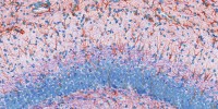 image: Brain Mosaic