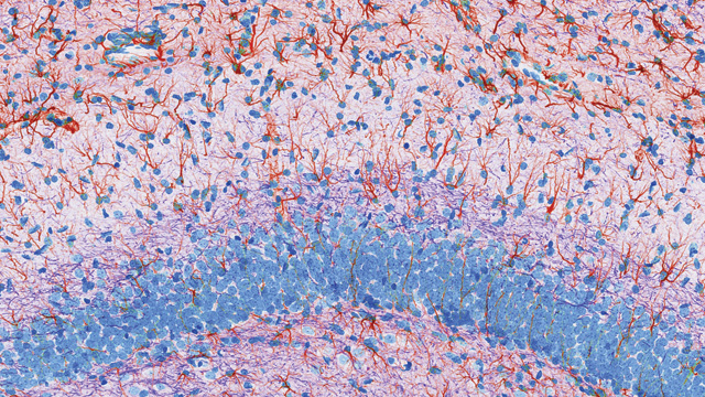 Brain Mosaic image: Brain Mosaic