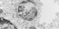 image: Munching Macrophages
