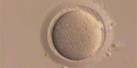 image: Ovarian Stem Cell Debate 