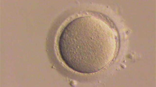 Ovarian Stem Cell Debate image: Ovarian Stem Cell Debate
