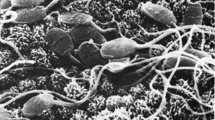 Surprising Sperm Diversity image: Surprising Sperm Diversity