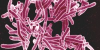 image: Resisting TB