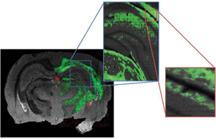 PICTURING RAT BRAIN LIPIDS: Tissue slice shown at different resolutions, down to 5 micrometers (far right). The gray color represents total ions (no chemistry) and the green denotes cholesterol.