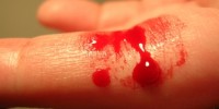 image: Kerfuffle Over Antishock Drug Paper 