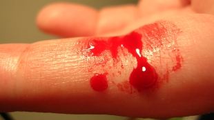 Kerfuffle Over Antishock Drug Paper image: Kerfuffle Over Antishock Drug Paper