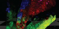 image: Cancer Stem Cells Really Do Exist?