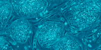 image: Stem Cell Research Funding Upheld