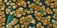 image: Soil Harbors Antibiotic Resistance