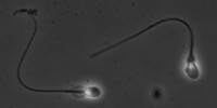 image: Creating Sperm from Skin