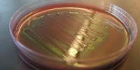 image: Cancer-Causing Gut Bacteria   