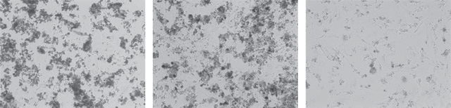 BONE-IN: A sign of osteogenesis, calcification is missing in mouse ESC cultures exposed to osteotoxic compounds (right) compared with cells treated with nontoxic compounds (center) and untreated controls (left).