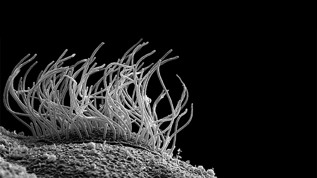 This lateral view of a cilliated epidermis cell of a Xenopus embryo shows off the cell's many motile, apical cilia.Courtesy of John Wallingford