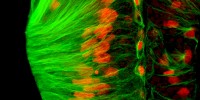 Wallingford discovered a novel protein, Shroom3, regulates the microtubule cytoskeleton during epithelial morphogenesis by inducing the redistribution of the microtubule building block, tubulin (green). This image shows tubulin distribution in Xenopus cement gland epithelial cells (nuclei shown in red). Courtesy of John Wallingford