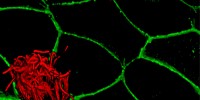This image shows ciliated cells of a developing Xenopus embryoCourtesy of John Wallingford