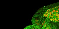 Wallingford's team has found that Shroom family proteins are necessaryfor driving the cell shape changes that bend epithelial tissues. Courtesy of John Wallingford