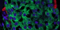 image: Transformer Cells in Diabetes