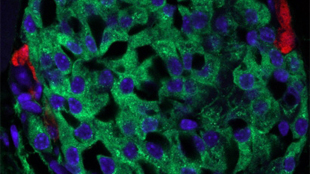 Transformer Cells in Diabetes image: Transformer Cells in Diabetes
