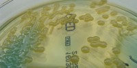 image: NIH Clinic Outbreak Kills Again