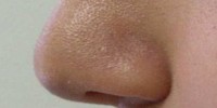 image: Bacterial Sentinels of Noses