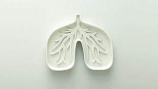 Cystic Fibrosis Alters Microbiome? image: Cystic Fibrosis Alters Microbiome?