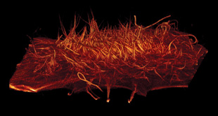 PENCILS OF LIGHT: Cytoskeletal spikes, known as filopodia, at the upper surface of the HeLa cancer cell, as seen by Bessel beam plane illumination microscopy, which sweeps a thin “pencil” of light across a sample to produce a focused light sheet