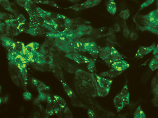 IMAGING VIRAL INFECTION: Cultured cells infected with influenza virus carrying a GFP reporter gene