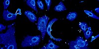 Blue Vero cells. The vero cell line was originally developed in the 1960s from kidney epithelial cells isolated from an African green monkey.Submitted by Marilia Koch