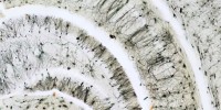 FINALIST: By stitching together 40 high-resolution shots of the hippocampal region of a mouse model of Down syndrome, neurobiologist Ahmad Salehi created this single hyper-informative image which presents a global view of the hippocampus with enough resolution to examine the connections of individual dendrites.Ahmad Salehi