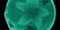 WINNER: The giant unilamellar liposome featured in this winning image is 40 µm in diameter and is composed of ceramide, cholesterol, and the glycerophospholipid POPC. The star-shaped region is formed by the crystallization of ceramide-rich lipids.Luis Bagatolli